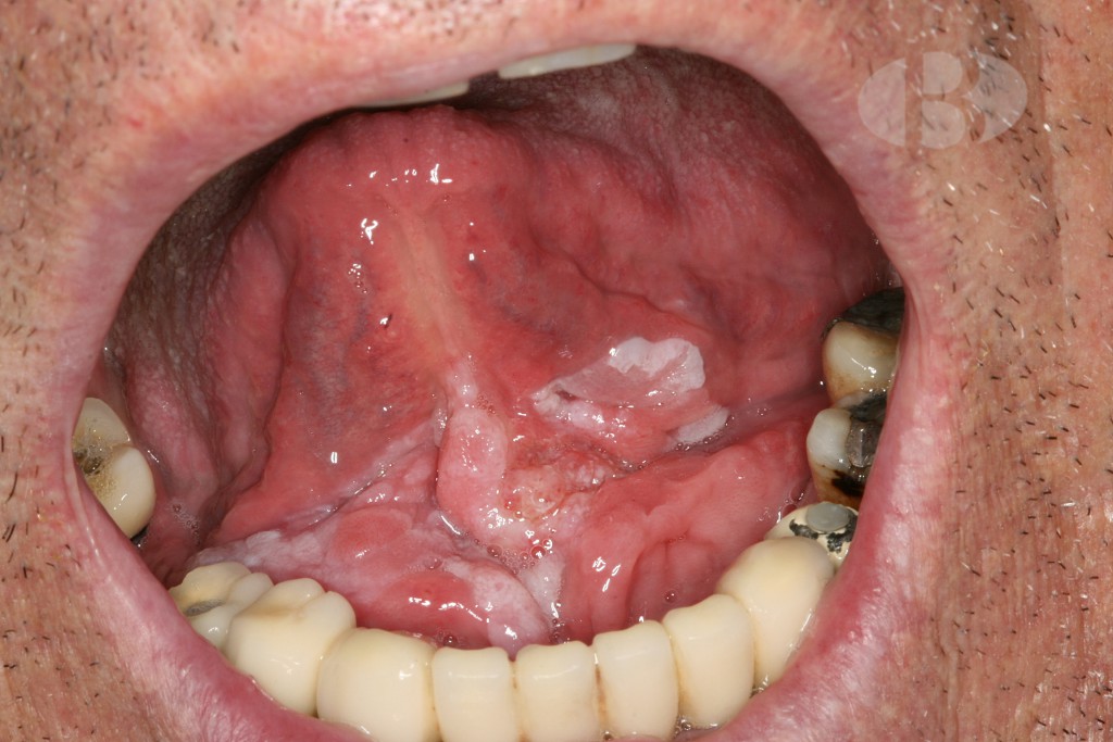 Patología Bucodental-513-C