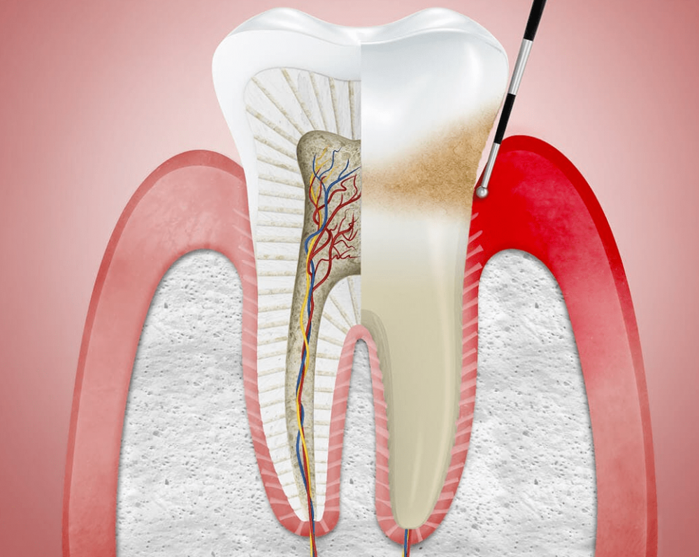 Periodoncia-913-A