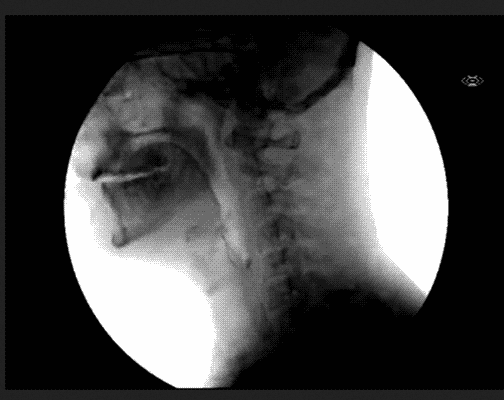 Cirugía cardiotorácica-714-A