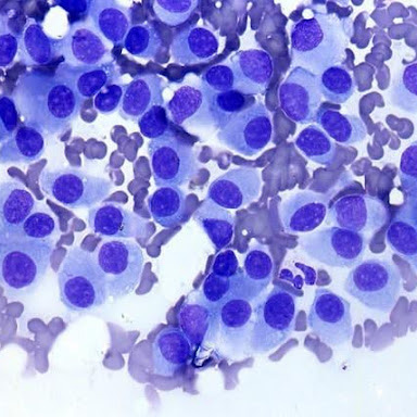 Anatomía y Fisiología Patológica II-614-A