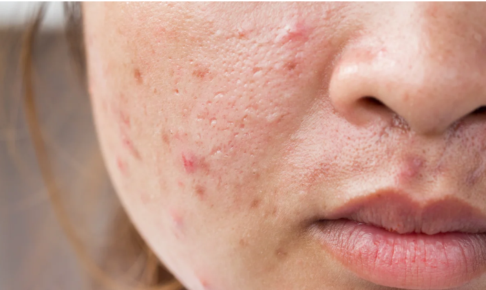 Dermatología-1014-C