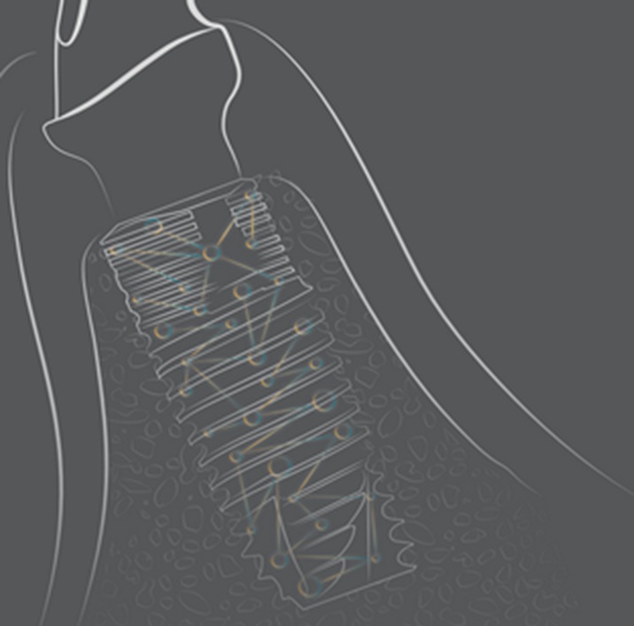 Bases de la Implantología-1013-B